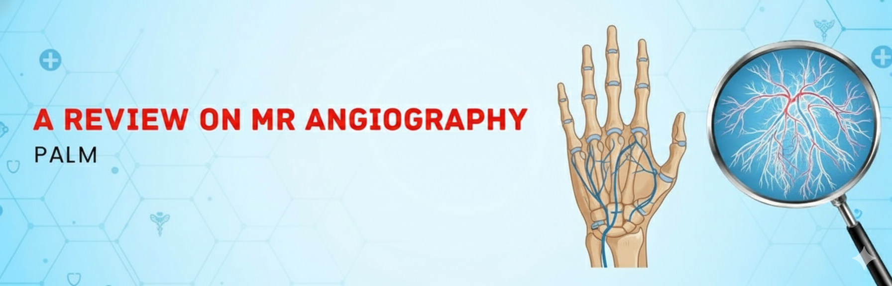 A Review on MR Angiography Palm